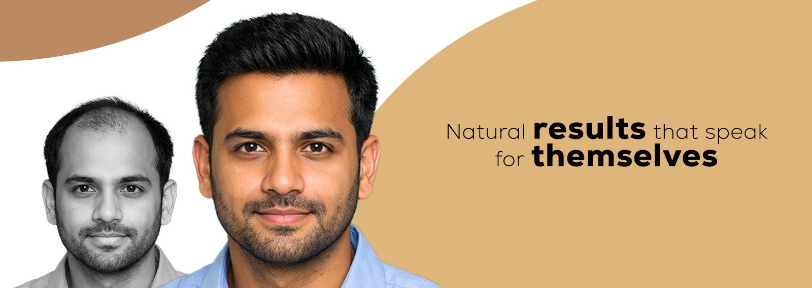 Hair Reborn — Clinic & Care